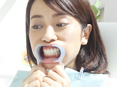 6. マウスオープナー装着